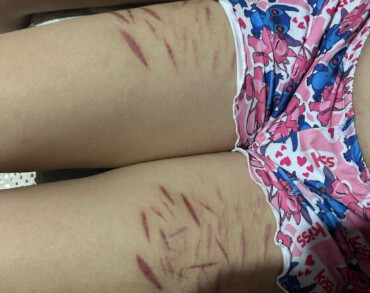 VILOÊNCIA EXTREMA