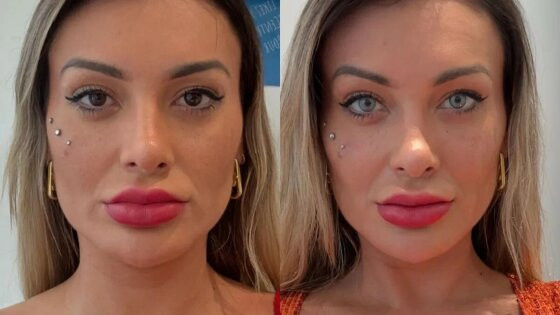 antes-e-depois-andressa-urach (1).jpg