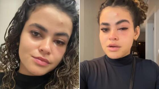 Influencer com infecção no olho.jpeg